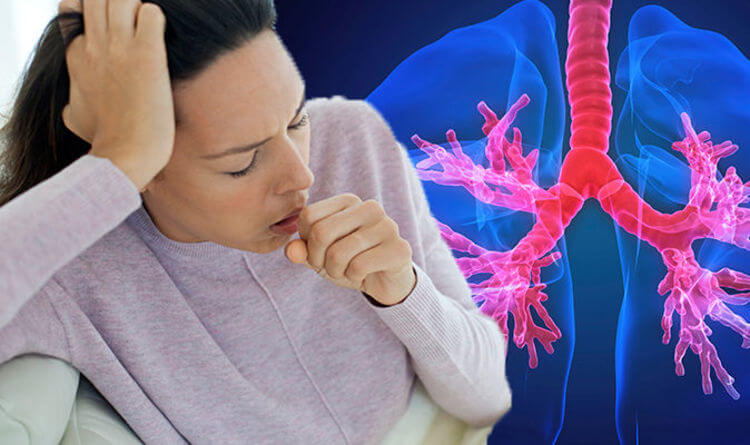 Chronic cough Holistic integrative approach