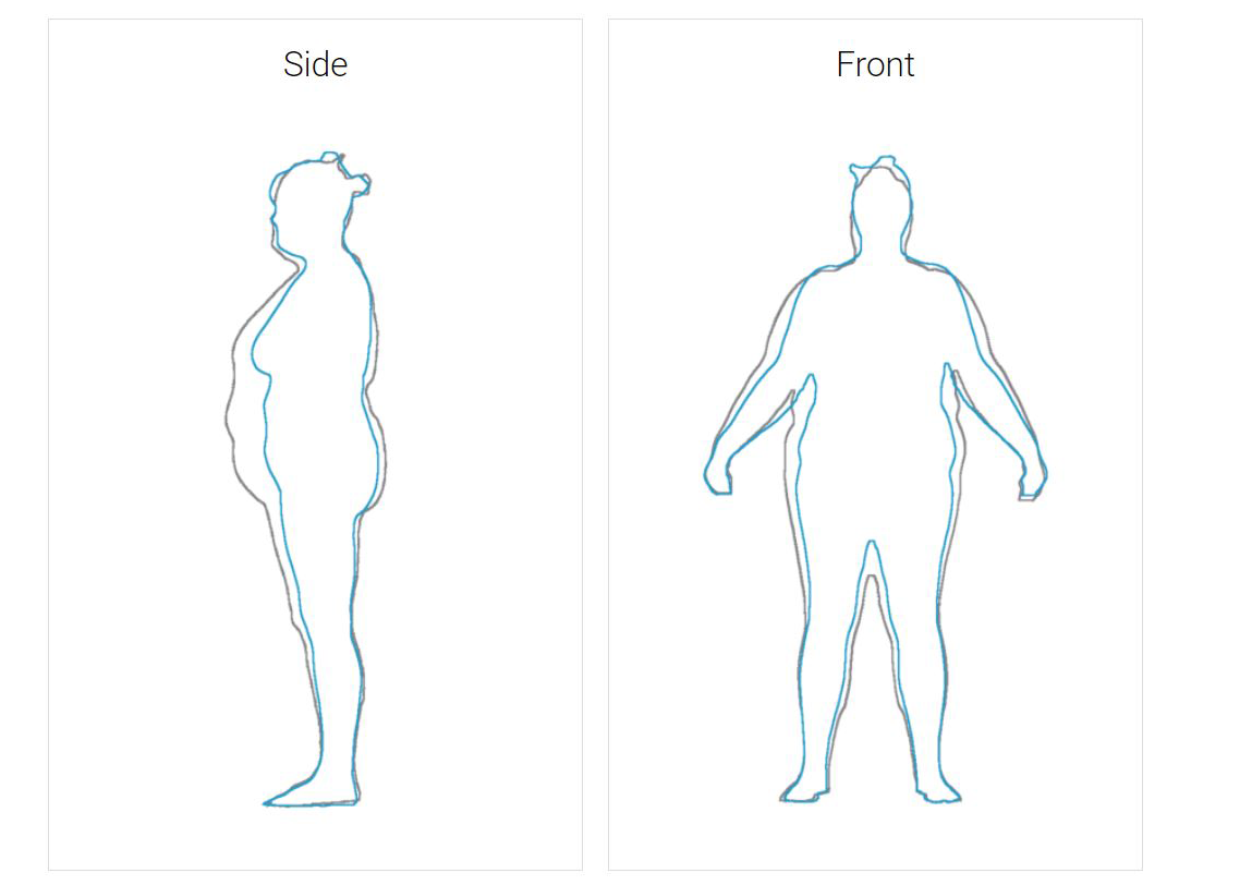 What Are The Different Types Of Body Scans