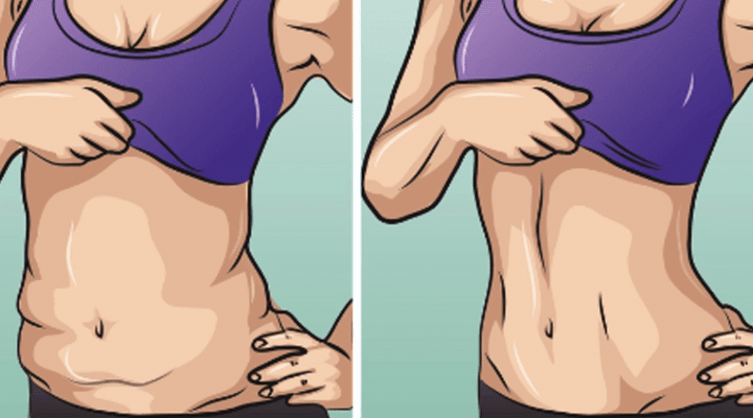 Can You Actually Tighten Loose Skin After Weight Loss