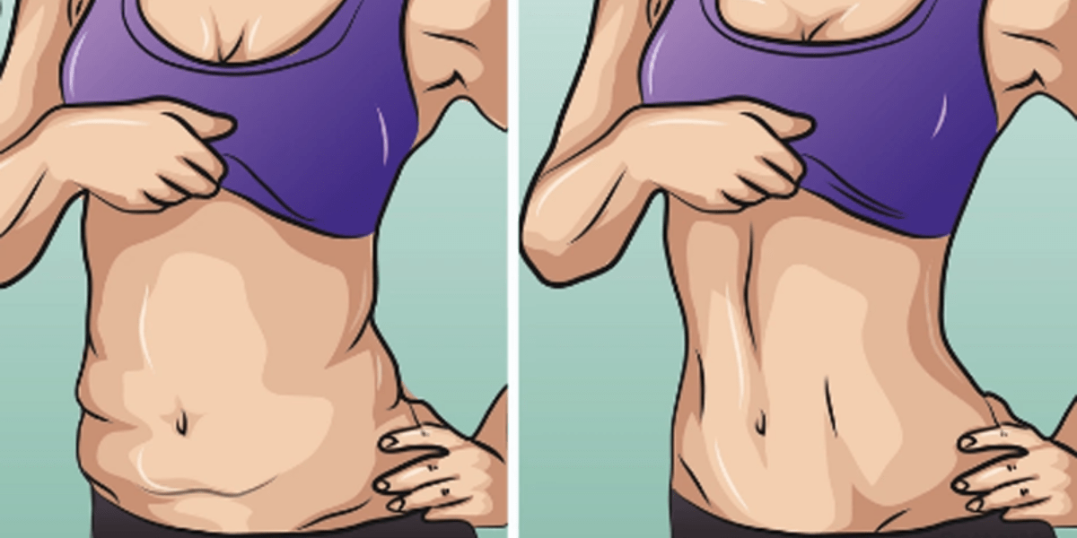 Can You Actually Tighten Loose Skin After Weight Loss